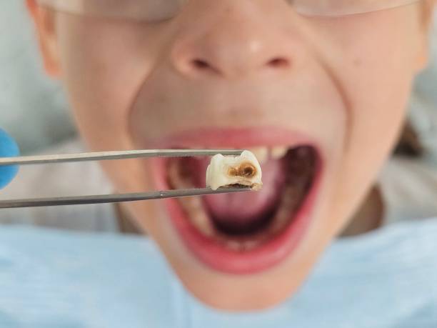 Best Urgent Dental Care for Toothache in Carleton, MI